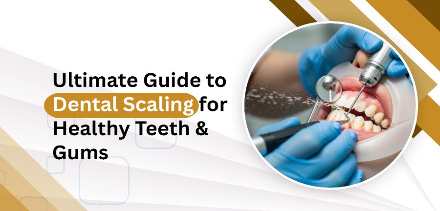 Ultimate Guide to Dental Scaling for Healthy Teeth & Gums