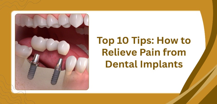 Relieve Pain from Dental Implants