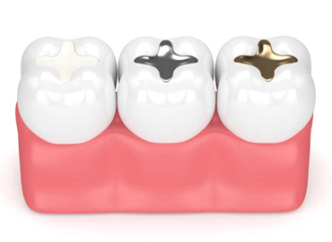 FILLINGS